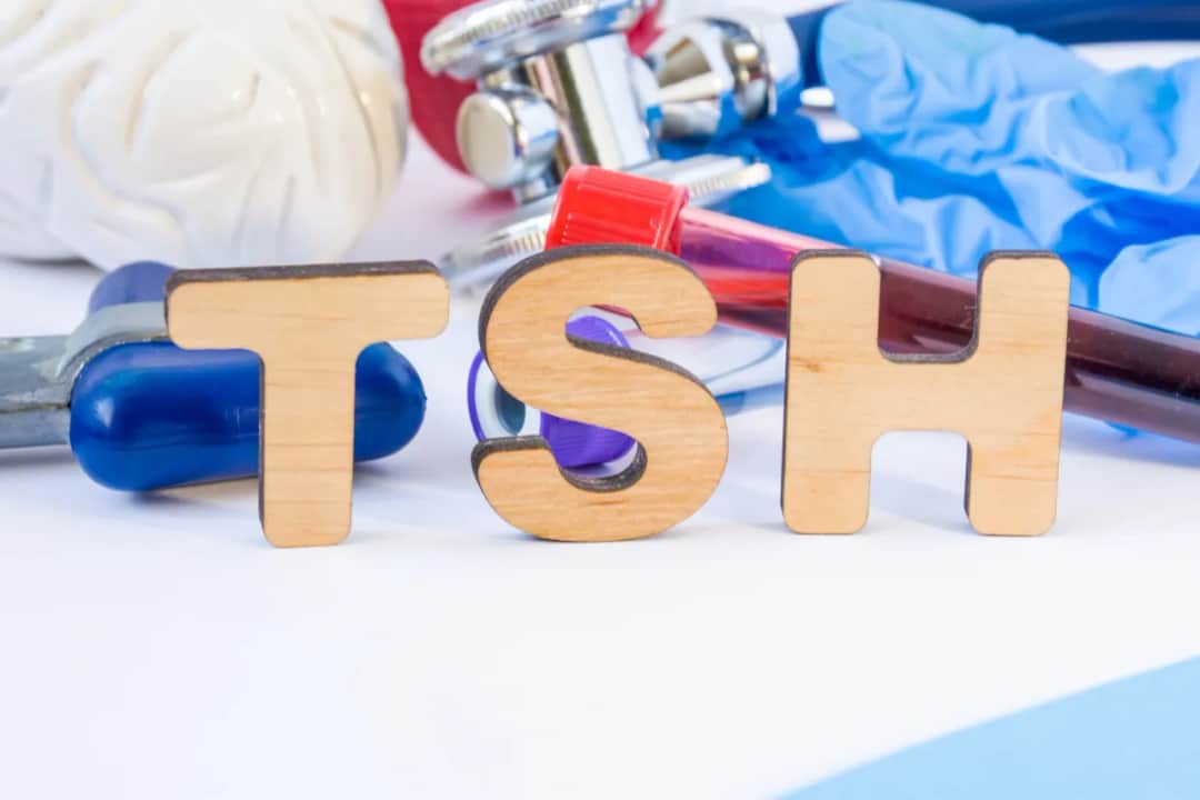 Czy można pić kawę przed badaniem tsh? Sprawdź, co musisz wiedzieć