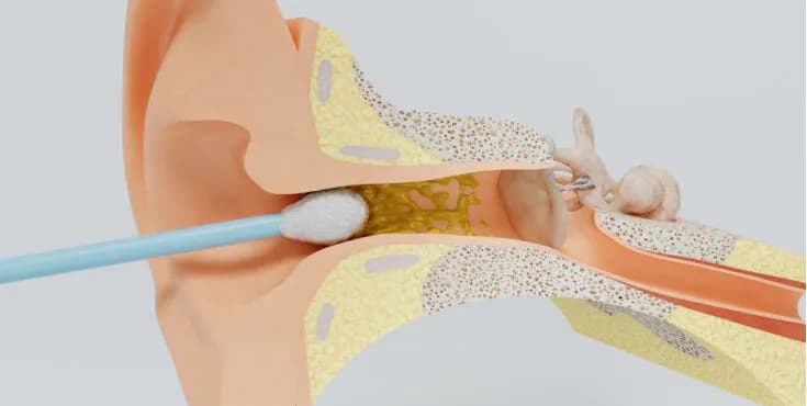 Skąd się bierze miód w uszach i dlaczego warto go zrozumieć